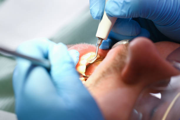  Poplar Cotton Center, CA Emergency Dentist Pros