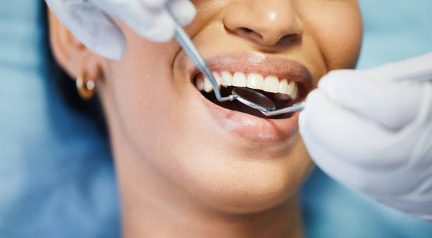 Best Emergency Dentist for Knocked-Out Tooth in Poplar Cotton Center, CA
